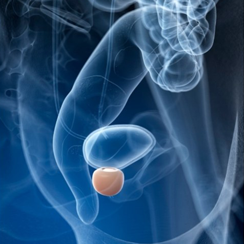 PROSTATA SALUDABLE